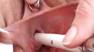 খেলনা, মেডিকেল সেক্স ভিডিও মেয়েদের হস্তমৈথুন